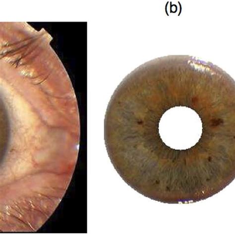 Example Of Fully Automated Iris Segmentation And Eye Colour