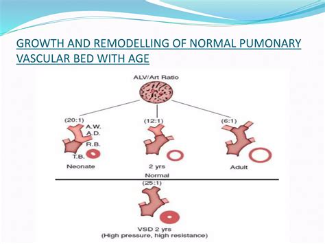 Pediatric Pulmonary Hypertension Ppt