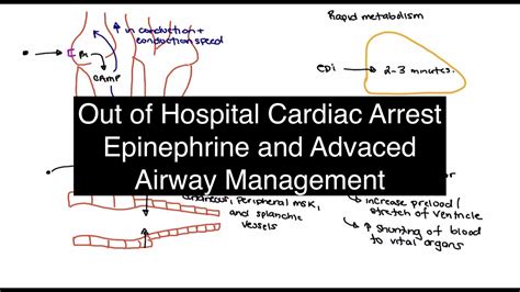 Out Of Hospital Cardiac Arrest Epinephrine And Advanced Airway