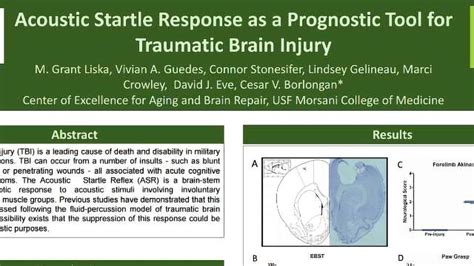 Acoustic Startle Response as a Prognostic Tool for Traumatic Brain Injury | Technology Networks