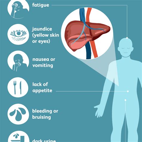 Hepatitis C Virus Signs Symptoms And Complications