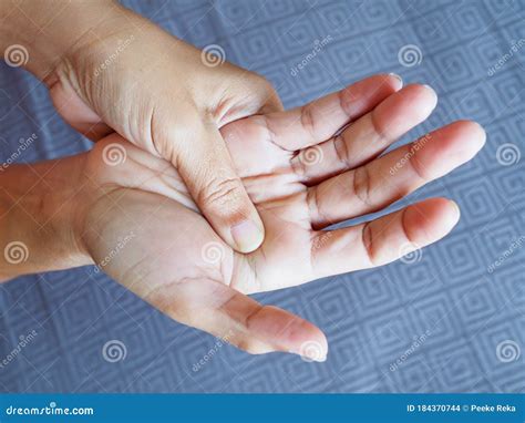 Woman Suffering With Hand Pain And Palms Beriberi Symptom On Hand And