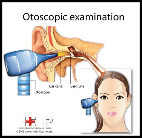 The causes of ear congestion what is ear congestion congestion ear earinfection – Artofit