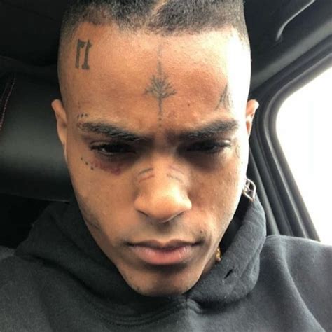 Stream Xxxtentacion Bad Vibes Forever Remix By Will Gale Listen