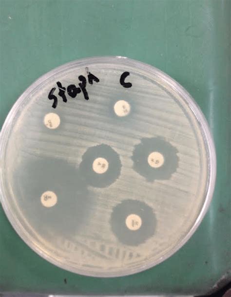 Antibiotic Susceptibility Test Performed By Using The Kirby Bauer Disk