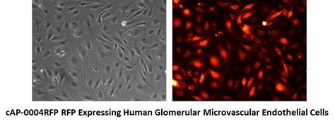 Rfp Expressing Human Glomerular Microvascular Endothelial Cells Angio