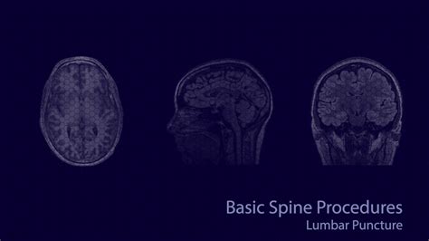 Procedures Learn Neuroradiology