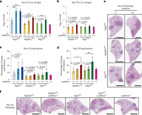 Atg16l1 And Atg7 Mutant Mice Display Lung Lesions At Later Stages Of