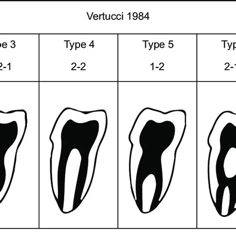 Pdf Hypercementosis