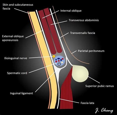 Inguinal Canal Content Anatomy