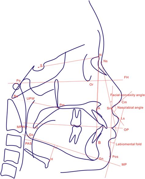 Schematic Diagram Showing The Cephalometric Measurement S Sella N