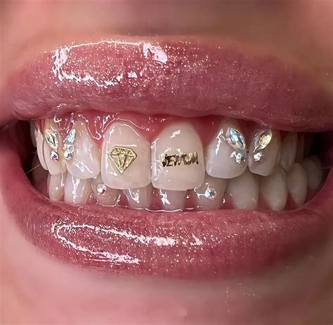 A Sparkling Trend The Rise Of Tooth Gems