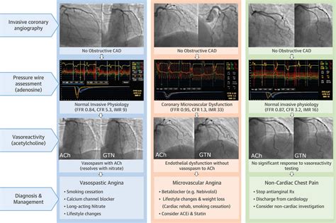 Phenotype Based Management Of Coronary Microvascular Dysfunction