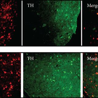 Exogenous High H Syn Expression In The Snc A Representative Images