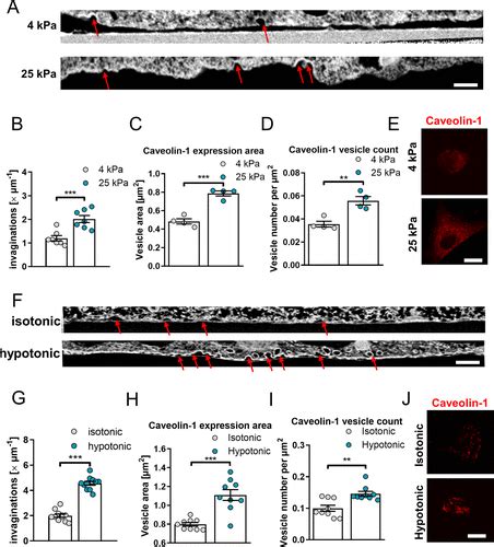 Substrate Stiffness Driven Membrane Tension Modulates Vesicular