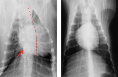 Thoracic Imaging Flashcards Quizlet