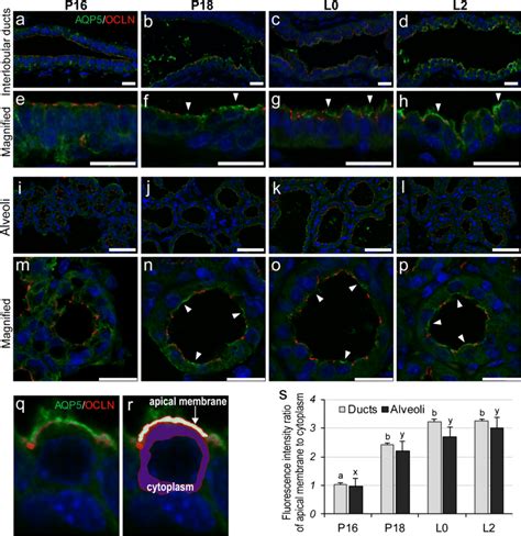 AQP5 Localization In Ductal And Alveolar MECs Of Mammary Glands Before