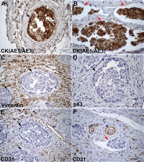 Photomicrographs Illustrating Cytokeratin AE1 AE3 Vimentin P63 And