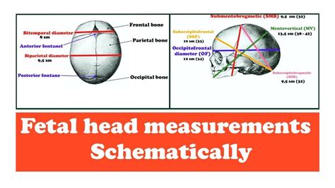 Sutures Of The Fetal Skull