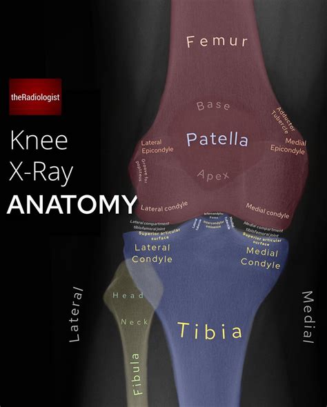 TheRadiologist On Twitter AP Knee X Ray Anatomy