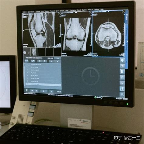 X线、ct、磁共振，经常膝盖疼选择哪个检查更靠谱 知乎