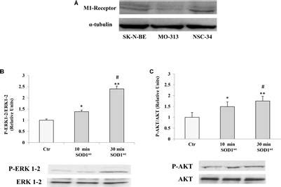 Frontiers Effect Of Mutated Cu Zn Superoxide Dismutase Sod G A On