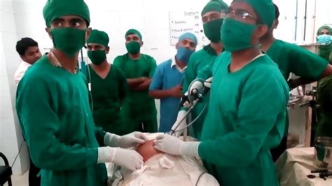 Laparoscopic Appendectomy Youtube