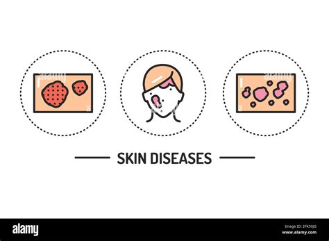 Skin Diseases Color Line Icons Concept Isolated Vector Element