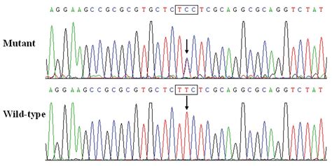 A Novel NKX2 5 Loss Of Function Mutation Responsible For Familial