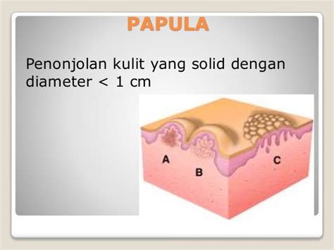 Efloresensi Modul Kulit Dan Jaringan Penunjang