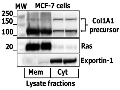 Collagen 1 Antibody (BS-10423R)