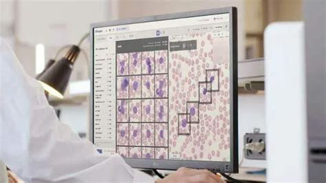 Israels Scopio Labs Adds Worlds First Digital Bone Marrow Imaging And