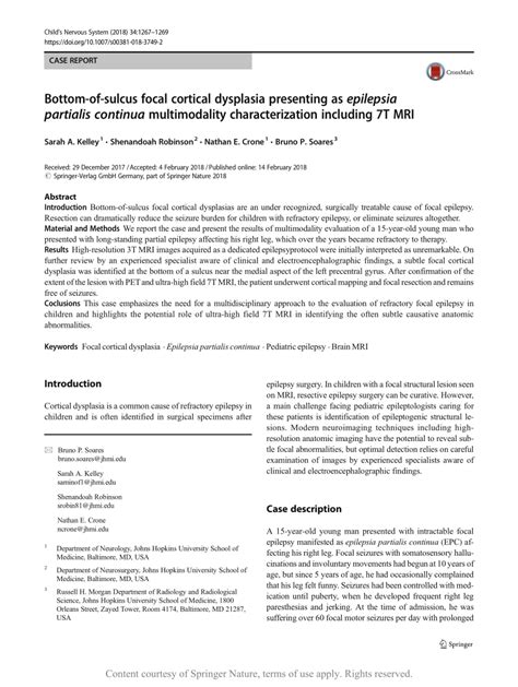 Bottom Of Sulcus Focal Cortical Dysplasia Presenting As Epilepsia