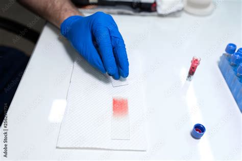 scientist prepare blood sample for research on microscope. Placing ...