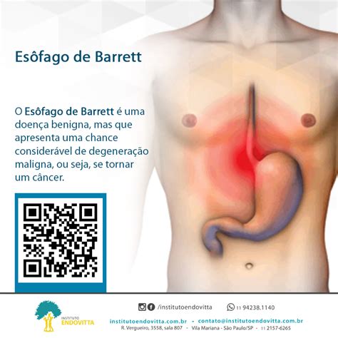 Esôfago de Barrett Instituto EndoVitta