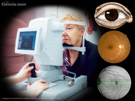 En El Día Mundial Del Glaucoma Una Enfermedad Peligrosa Y Silenciosa