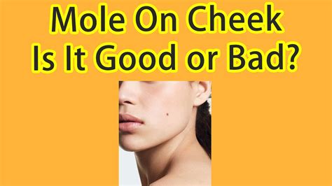 Chinese Face Reading Mole On The Face Is It Good Or Bad Should You Remove The Mole On The