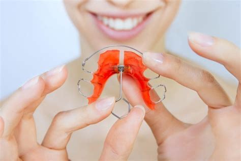 Drawbacks Of Permanent Retainers That You Should Know About Orthodontist Dublin James