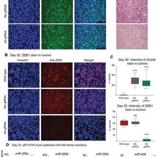 CRISPRdCas9 Silencing Of ZEB1 Reprograms The Mesenchymal Phenotype