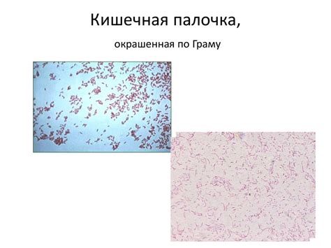 Основы микробиологии и иммунологии - презентация онлайн