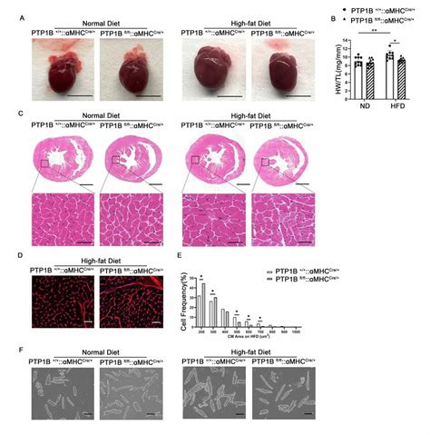 Cardiomyocyte Specific Deletion Of PTP1B Prevents HFD Induced