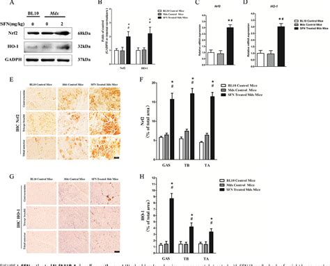 Figure 1 From Sulforaphane Attenuates Muscle Inflammation In Dystrophin