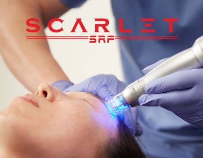 Scarlet Rf Microneedling Hayes Valley Medical Esthetics