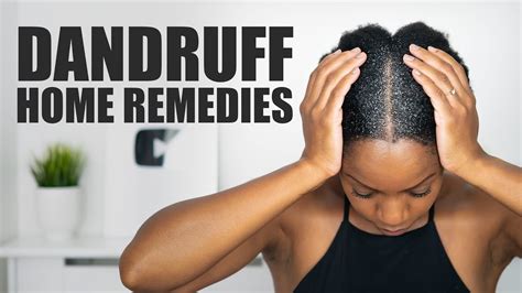 8 Home Remedies To Fight Dandruff Youtube