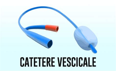 Perditi Campata Influente Catetere Vescicale Circuito Chiuso Direttore