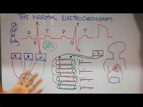 Cvs Physiology The Normal Electrocardiogram Ecg Ecg Leads