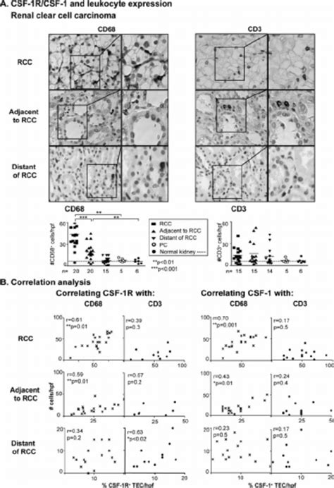 Csf 1r And Csf 1 Expression On Rcc And Tec That Are Adjacent To Rcc Download Scientific Diagram