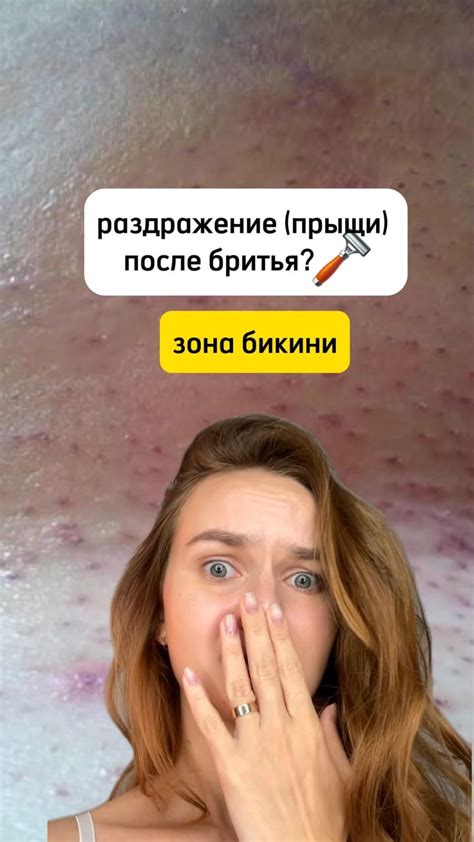 Прыщи после бритья?🪒 Зона бикини | Советы для бритья, Лечение прыщей ...