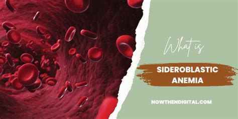 What Deficiency Causes Sideroblastic Anemia Now Then Digital