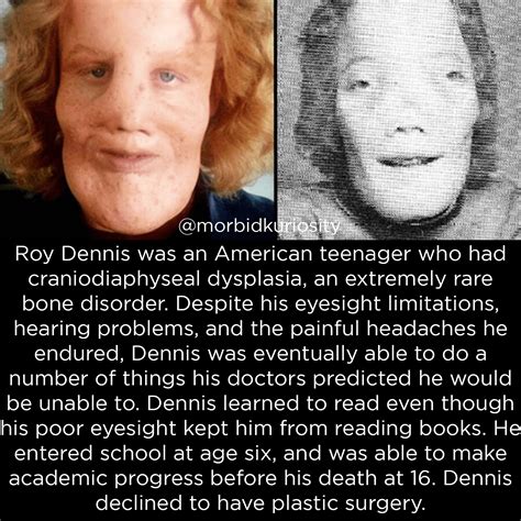 The Incredible Life of Rocky Dennis. I'm sure we all saw the movie with